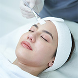 Peeling Acne